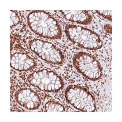 RSRC2, Rabbit, Polyclonal Antibody, Abnova 100 &mu;L | Buy Online | Abnova Corporation | Fisher Scientific