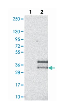 CD99L2 Rabbit anti-Human, Polyclonal Antibody, Abnova 100 &mu;L | Buy Online | Abnova | Fisher Scientific