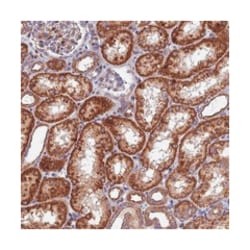 KIAA1468 Rabbit anti-Human, Polyclonal Antibody, Abnova 100 &mu;L | Buy Online | Abnova Corporation | Fisher Scientific