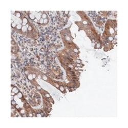 TMEM39B Rabbit anti-Human, Polyclonal Antibody, Abnova 100 &mu;L | Buy Online | Abnova Corporation | Fisher Scientific