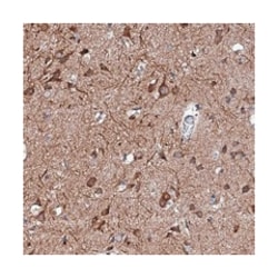RAB12, Rabbit, Polyclonal Antibody, Abnova 100 &mu;L | Buy Online | Abnova Corporation | Fisher Scientific