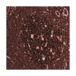 ADAT1 Rabbit anti-Human, Polyclonal Antibody, Abnova 100&mu;L; Unlabeled:Antibodies,