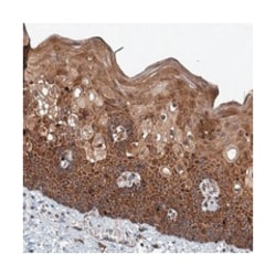 TXNDC11 Rabbit anti-Human, Polyclonal Antibody, Abnova 100&mu;L; Unlabeled:Antibodies,