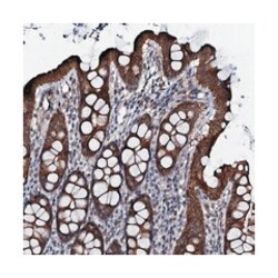 EVX2, Rabbit, Polyclonal Antibody, Abnova 100 &mu;L | Buy Online | Abnova Corporation | Fisher Scientific