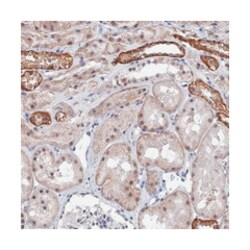 TSSC4, Rabbit, Polyclonal Antibody, Abnova 100&mu;L; Unlabeled:Antibodies,