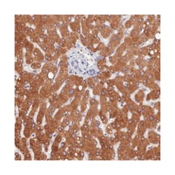 PPP4R4, Rabbit, Polyclonal Antibody, Abnova 100 &mu;L | Buy Online | Abnova Corporation | Fisher Scientific