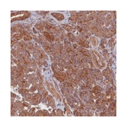 ZNF646, Rabbit, Polyclonal Antibody, Abnova 100 &mu;L | Buy Online | Abnova Corporation | Fisher Scientific