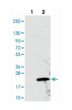 PRELID2, Rabbit, Polyclonal Antibody, Abnova 100&mu;L; Unlabeled:Antibodies,