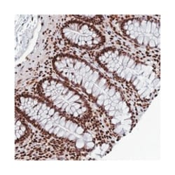 INO80E, Rabbit, Polyclonal Antibody, Abnova 100&mu;L; Unlabeled:Antibodies,