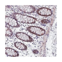 TRIML2, Rabbit, Polyclonal Antibody, Abnova 100 &mu;L | Buy Online | Abnova Corporation | Fisher Scientific