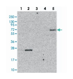 ZNF623, Rabbit, Polyclonal Antibody, Abnova 100 &mu;L | Buy Online | Abnova Corporation | Fisher Scientific