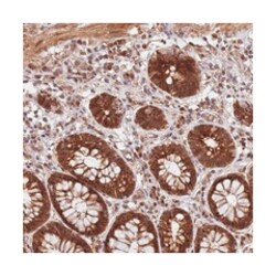 GPATCH8, Rabbit, Polyclonal Antibody, Abnova 100&mu;L; Unlabeled:Antibodies,