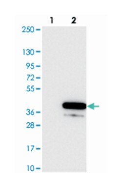 C20orf111, Rabbit, Polyclonal Antibody, Abnova 100 &mu;L | Buy Online | Abnova Corporation | Fisher Scientific