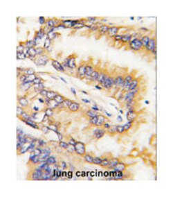 BID Rabbit anti-Human, Polyclonal Antibody, Abnova 400 &mu;L | Buy Online | Abnova Corporation | Fisher Scientific