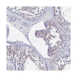 IGSF11, Rabbit, Polyclonal Antibody, Abnova 100&mu;L; Unlabeled:Antibodies,