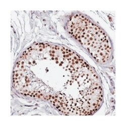 FCF1, Rabbit, Polyclonal Antibody, Abnova 100 &mu;L | Buy Online | Abnova Corporation | Fisher Scientific