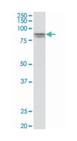 CDH1, Goat, Polyclonal Antibody, Abnova 100 &mu;g | Buy Online | Abnova Corporation | Fisher Scientific