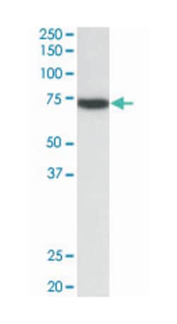 ZAP70, Goat, Polyclonal Antibody, Abnova 100 &mu;g | Buy Online | Abnova Corporation | Fisher Scientific