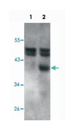 RCAN1, Goat, Polyclonal Antibody, Abnova 100 &mu;g | Buy Online | Abnova Corporation | Fisher Scientific
