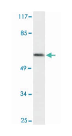 CDC25C Rabbit anti-Human, Polyclonal Antibody, Abnova 100&mu;L; Unlabeled:Antibodies,