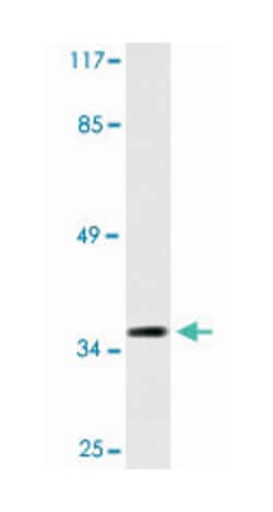 LGALS4, Rabbit, Polyclonal Antibody, Abnova 100&mu;L; Unlabeled:Antibodies,