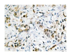 LGALS4, Rabbit, Polyclonal Antibody, Abnova 100&mu;L; Unlabeled:Antibodies,