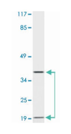 TRB@ Rabbit anti-Human, Polyclonal Antibody, Abnova 100&mu;L; Unlabeled:Anticuerpos