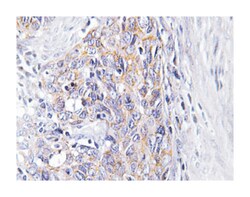CLN6 Rabbit anti-Human, Polyclonal Antibody, Abnova 100&mu;L; Unlabeled:Antibodies,