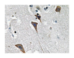 LEPR Rabbit anti-Human, Polyclonal Antibody, Abnova 100 &mu;L | Buy Online | Abnova | Fisher Scientific