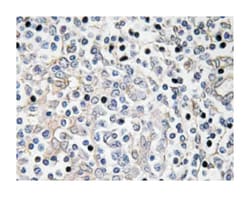 IL16 Rabbit anti-Human, Polyclonal Antibody, Abnova 100 &mu;L | Buy Online | Abnova Corporation | Fisher Scientific