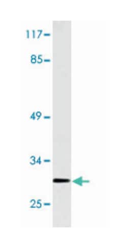 GSTT1, Rabbit, Polyclonal Antibody, Abnova 100&mu;L; Unlabeled:Antibodies,