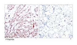 ATF2 (phospho T55/T73), Rabbit anti-Human, Mouse, Rat, Polyclonal Antibody,