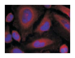 SYT1 (phospho S309), Rabbit anti-Human, Mouse, Rat, Polyclonal Antibody, Abnova 100 &mu;g | Buy Online | Abnova Corporation | Fisher Scientific