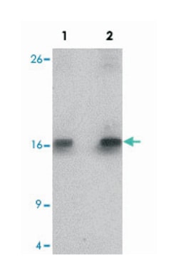 SDHD, Rabbit, Polyclonal Antibody, Abnova 100&mu;g; Unlabeled:Antibodies,