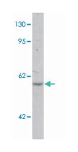 HHATL Rabbit anti-Human, Mouse, Rat, Polyclonal Antibody, Abnova 100 &mu;g | Buy Online | Abnova Corporation | Fisher Scientific