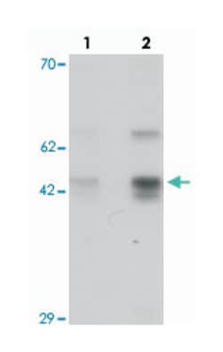 SLC35D3 Rabbit anti-Human, Mouse, Polyclonal Antibody, Abnova 100&mu;g;