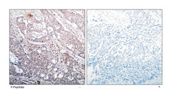 NFKBIB (phospho S23), Rabbit anti-Human, Mouse, Rat, Polyclonal Antibody, Abnova 100 &mu;g | Buy Online | Abnova Corporation | Fisher Scientific