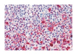 WNT16 Rabbit anti-Human, Polyclonal Antibody, Abnova 50 &mu;g | Buy Online | Abnova Corporation | Fisher Scientific
