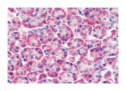 FZD6, Rabbit, Polyclonal Antibody, Abnova 50 &mu;g | Buy Online | Abnova Corporation | Fisher Scientific