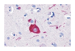 GPR116 Rabbit anti-Human, Monkey, Polyclonal Antibody, Abnova 50 &mu;g | Buy Online | Abnova Corporation | Fisher Scientific