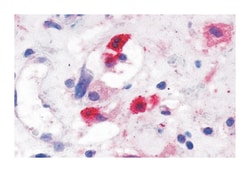 GPR44 Rabbit anti-Human, Polyclonal Antibody, Abnova 50&mu;g; Unlabeled:Anticuerpos