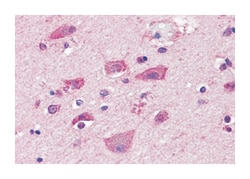 GRM7, Rabbit, Polyclonal Antibody, Abnova 50&mu;g; Unlabeled:Antibodies,