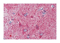 MC3R, Rabbit, Polyclonal Antibody, Abnova 50 &mu;g | Buy Online | Abnova Corporation | Fisher Scientific