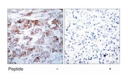 BCL2 Rabbit anti-Human, Polyclonal Antibody, Abnova 100 &mu;g | Buy Online | Abnova Corporation | Fisher Scientific