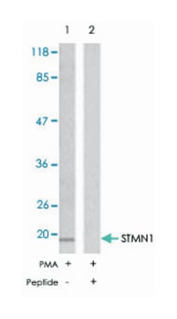 STMN1 Rabbit anti-Human, Mouse, Rat, Polyclonal Antibody, Abnova 100 &mu;g | Buy Online | Abnova Corporation | Fisher Scientific