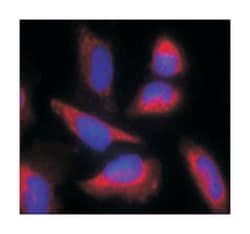 NOS3 Rabbit anti-Human, Mouse, Rat, Polyclonal Antibody, Abnova 100 &mu;g | Buy Online | Abnova | Fisher Scientific