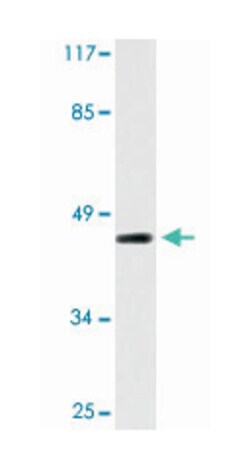 WWOX Rabbit anti-Human, Mouse, Polyclonal Antibody, Abnova 100 &mu;L | Buy Online | Abnova Corporation | Fisher Scientific