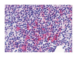 ZNF687 Rabbit anti-Human, Polyclonal Antibody, Abnova 100 &mu;g | Buy Online | Abnova Corporation | Fisher Scientific