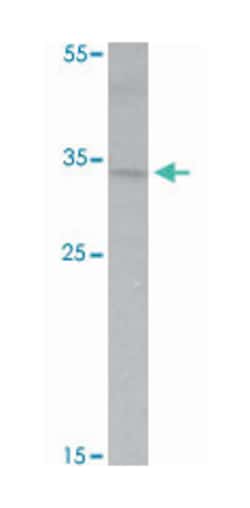 TRAP, Rabbit, Polyclonal Antibody, Abnova 100 &mu;g | Buy Online | Abnova Corporation | Fisher Scientific