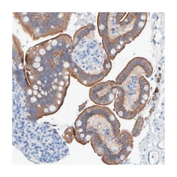 JAKMIP3, Rabbit, Polyclonal Antibody, Abnova 100&mu;L; Unlabeled:Antibodies,